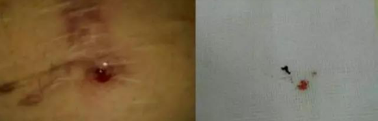\